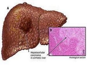 [Image: viemgan.jpg]