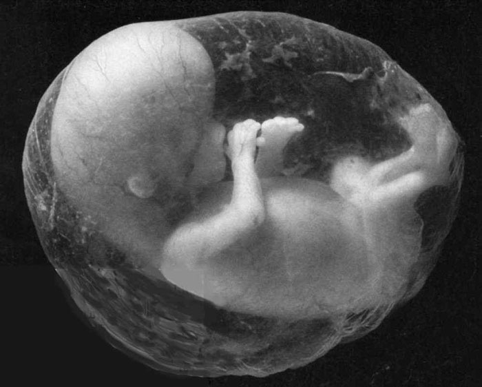 Hướng dẫn cách xác định giới tính thai nhi sớm siêu âm trắng đen