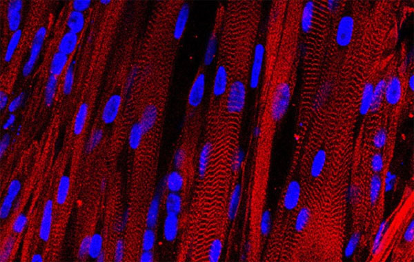 Cơ bắp nhân tạo sẽ giúp thử nghiệm thuốc trong tương lai Sẽ dùng cơ bắp nhân tạo để thử nghiệm thuốc?