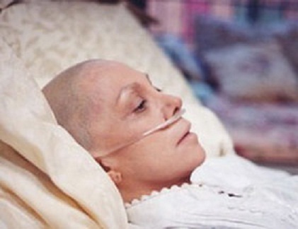 Biểu hiện của bệnh nhân ung thư giai đoạn cuối