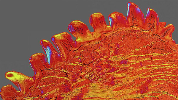 10 hình ảnh gây chấn động về thành tựu khoa học y tế năm 2015
