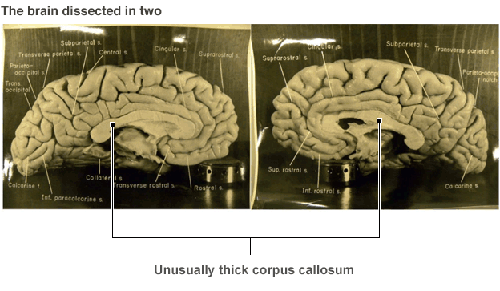 Những chuyện chưa kể về bộ não Einstein